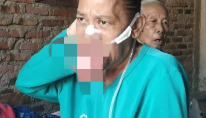 Menderita Penyakit Kanker Mulut, Seorang Ibu di Kedungwaringin Butuh Uluran Tangan Demi Kesembuhannya