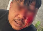 MMF Warga Dawuan Tengah Korban Dugaan Pengeroyokan Desak Polres Karawang Segera Tangkap Para Pelaku!